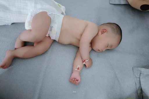 柳林宝宝脸上有白色斑块